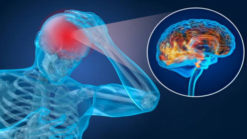 Inflammation